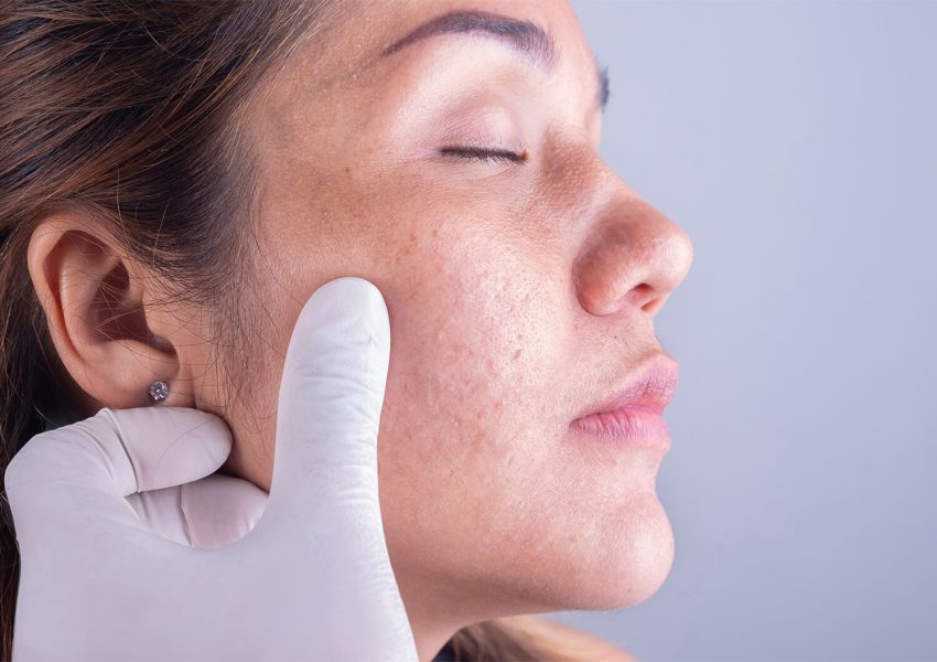 dermatologist kuwait