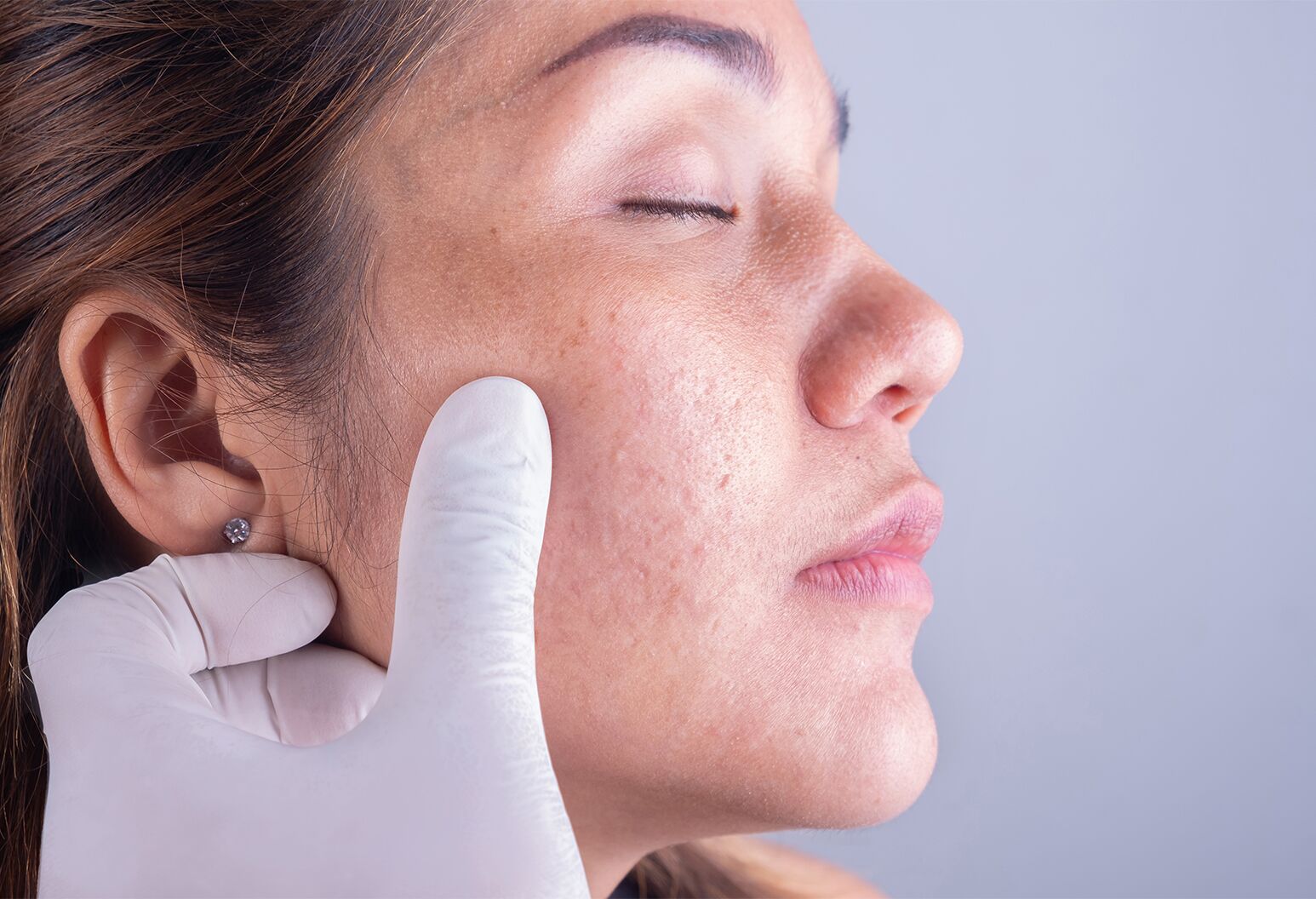 dermatologist kuwait